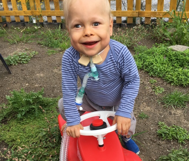 Kind mit Beatmungsschlauch auf Bobbycar