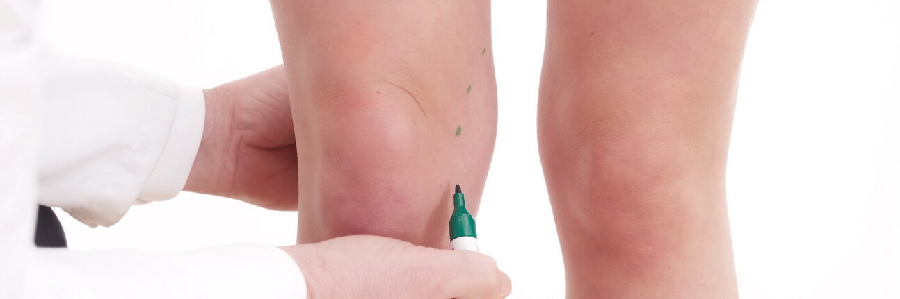 Einzeichnen ung von Punkten für einen Eingriff am Knie